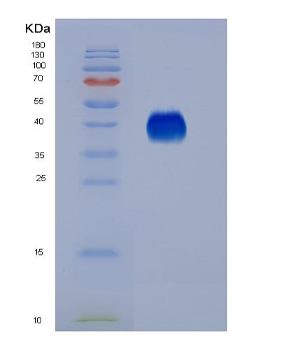 SDS-PAGE analysis of Human FCGR3A (Low Affinity Immunoglobulin Gamma Fc Region Receptor Iii-A) - Recombinant Protein, showing >95% purity under 15% SDS-PAGE (Reduced)