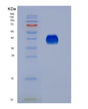 SDS-PAGE analysis of Human FCGR3A (Low Affinity Immunoglobulin Gamma Fc Region Receptor Iii-A) - Recombinant Protein, showing >95% purity under 15% SDS-PAGE (Reduced)