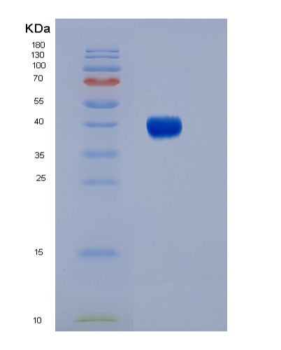 SDS-PAGE analysis of Human FCGR3B (Low Affinity Immunoglobulin Gamma Fc Region Receptor Iii-B) - Recombinant Protein, showing >90% purity under 15% SDS-PAGE (Reduced)