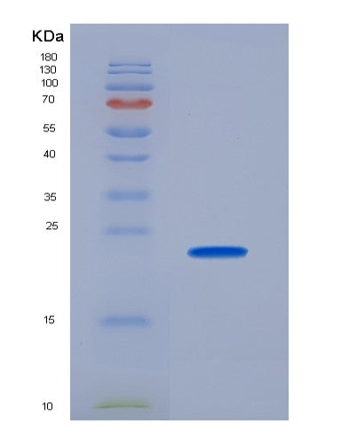 SDS-PAGE analysis of Human FGF4 (Fibroblast Growth Factor 4) - Recombinant Protein, showing >85% purity under 15% SDS-PAGE (Reduced)