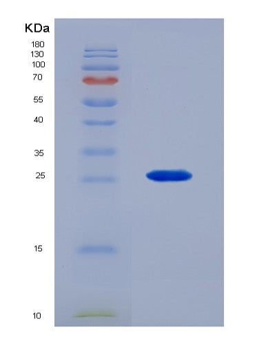 SDS-PAGE analysis of Human FGF9 (Fibroblast Growth Factor 9) - Recombinant Protein, showing >95% purity under 15% SDS-PAGE (Reduced)