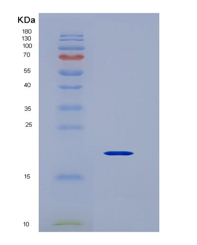 SDS-PAGE analysis of Human VEGFD (Vascular Endothelial Growth Factor D) - Recombinant Protein, showing >95% purity under 15% SDS-PAGE (Reduced)