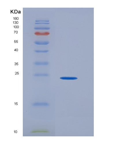 SDS-PAGE analysis of Human GH1 (Somatotropin) - Recombinant Protein, showing >95% purity under 15% SDS-PAGE (Reduced)