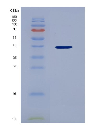 SDS-PAGE analysis of Human CXCL3 (C-X-C Motif Chemokine 3) - Recombinant Protein, showing >95% purity under 15% SDS-PAGE (Reduced)
