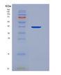 SDS-PAGE analysis of Human HDGF (Hepatoma-Derived Growth Factor) - Recombinant Protein, showing >90% purity under 15% SDS-PAGE (Reduced)