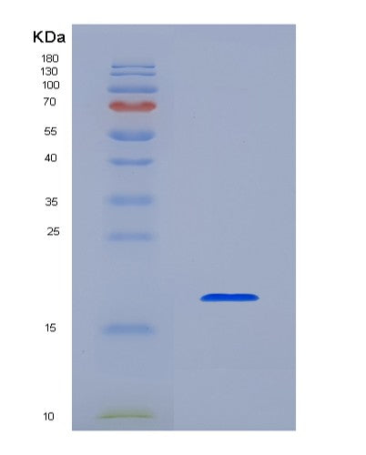 SDS-PAGE analysis of Human IL1B (Interleukin-1 Beta) - Recombinant Protein, showing >95% purity under 15% SDS-PAGE (Reduced)