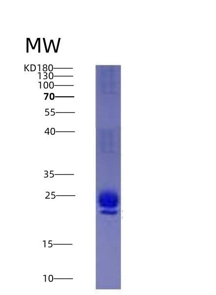 SDS-PAGE analysis of Human IL1RN (Interleukin-1 Receptor Antagonist Protein) - Recombinant Protein, showing >95% purity under 15% SDS-PAGE (Reduced)