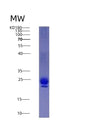 SDS-PAGE analysis of Human IL1RN (Interleukin-1 Receptor Antagonist Protein) - Recombinant Protein, showing >95% purity under 15% SDS-PAGE (Reduced)
