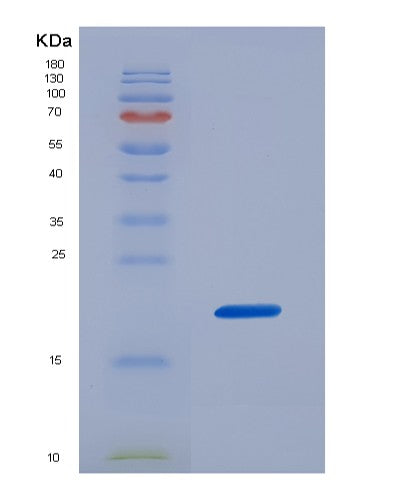 SDS-PAGE analysis of Mouse Il17b (Interleukin-17B) - Recombinant Protein, showing >90% purity under 15% SDS-PAGE (Reduced)