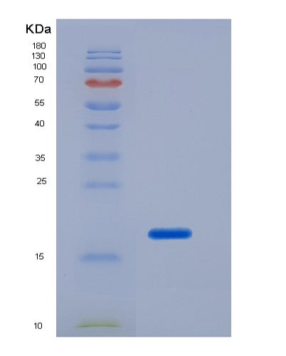 SDS-PAGE analysis of Human IL2 (Interleukin-2) - Recombinant Protein, showing >95% purity under 15% SDS-PAGE (Reduced)