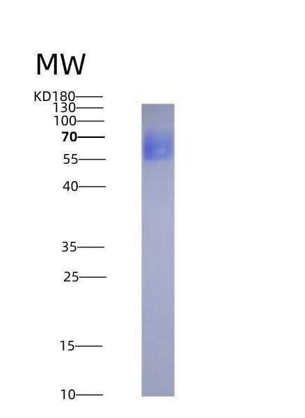 SDS-PAGE analysis of Human IL6R (Interleukin-6 Receptor Subunit Alpha) - Recombinant Protein, showing >95% purity under 15% SDS-PAGE (Reduced)