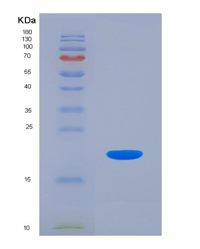 SDS-PAGE analysis of Human IL18 (Interleukin-18) - Recombinant Protein, showing >95% purity under 15% SDS-PAGE (Reduced)