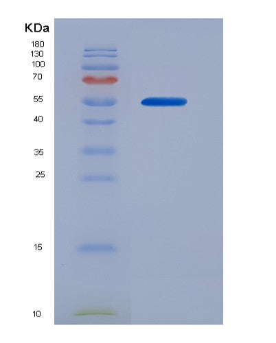 SDS-PAGE analysis of Human CANX (Calnexin) - Recombinant Protein, showing >90% purity under 15% SDS-PAGE (Reduced)