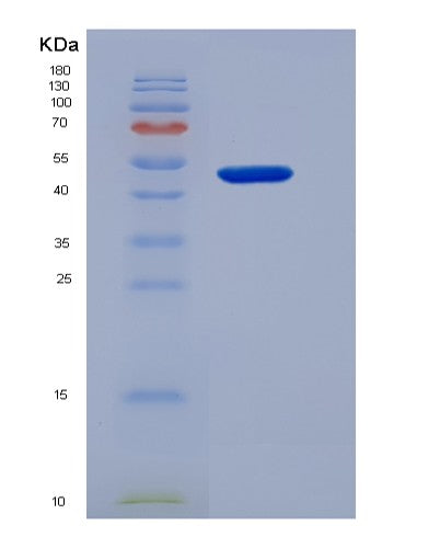 SDS-PAGE analysis of Human CHRNG (Acetylcholine Receptor Subunit Gamma) - Recombinant Protein, showing >90% purity under 15% SDS-PAGE (Reduced)