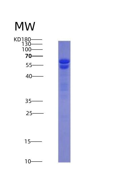 SDS-PAGE analysis of Human NUMA1 (Nuclear Mitotic Apparatus Protein 1) - Recombinant Protein, showing >95% purity under 15% SDS-PAGE (Reduced)