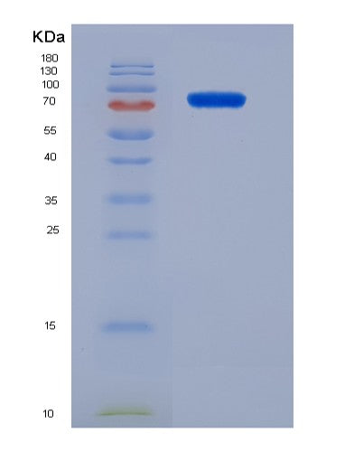 SDS-PAGE analysis of Human KDR (Vascular Endothelial Growth Factor Receptor 2) - Recombinant Protein, showing >95% purity under 15% SDS-PAGE (Reduced)