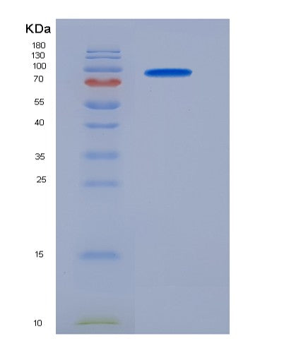 SDS-PAGE analysis of Human MME (Neprilysin) - Recombinant Protein, showing >95% purity under 15% SDS-PAGE (Reduced)