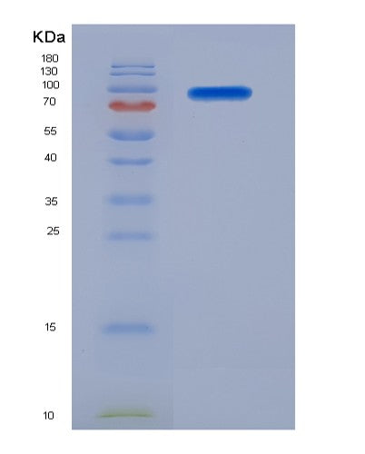SDS-PAGE analysis of Human NCAM1 (Neural Cell Adhesion Molecule 1) - Recombinant Protein, showing >90% purity under 15% SDS-PAGE (Reduced)