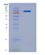 SDS-PAGE analysis of Human NCAM1 (Neural Cell Adhesion Molecule 1) - Recombinant Protein, showing >90% purity under 15% SDS-PAGE (Reduced)