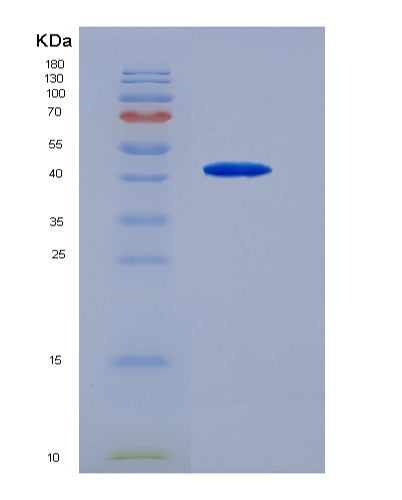 SDS-PAGE analysis of Human TNFRSF11B (Tumor Necrosis Factor Receptor Superfamily Member 11B) - Recombinant Protein, showing >95% purity under 15% SDS-PAGE (Reduced)