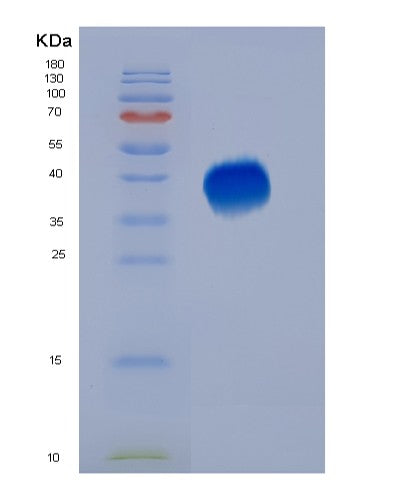 SDS-PAGE analysis of Human PDCD1 (Programmed Cell Death Protein 1) - Recombinant Protein, showing >95% purity under 15% SDS-PAGE (Reduced)