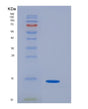 SDS-PAGE analysis of Human PPBP (Platelet Basic Protein) - Recombinant Protein, showing >90% purity under 15% SDS-PAGE (Reduced)