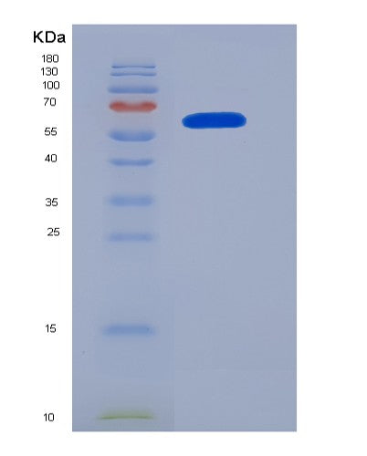 SDS-PAGE analysis of Human NRP1 (Neuropilin-1) - Recombinant Protein, showing >95% purity under 15% SDS-PAGE (Reduced)