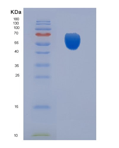 SDS-PAGE analysis of Human CDC123 (Translation Initiation Factor Eif2 Assembly Protein) - Recombinant Protein, showing >90% purity under 15% SDS-PAGE (Reduced)