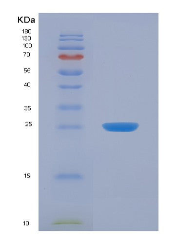SDS-PAGE analysis of Human FIBP (Acidic Fibroblast Growth Factor Intracellular-Binding Protein) - Recombinant Protein, showing >95% purity under 15% SDS-PAGE (Reduced)