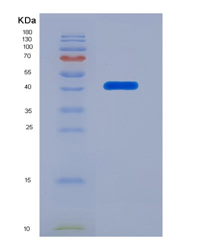 SDS-PAGE analysis of Human TNFSF13B (Tumor Necrosis Factor Ligand Superfamily Member 13B) - Recombinant Protein, showing >95% purity under 15% SDS-PAGE (Reduced)