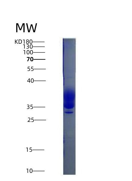 SDS-PAGE analysis of Mouse Csf1 (Macrophage Colony-Stimulating Factor 1) - Recombinant Protein, showing >90% purity under 15% SDS-PAGE (Reduced)