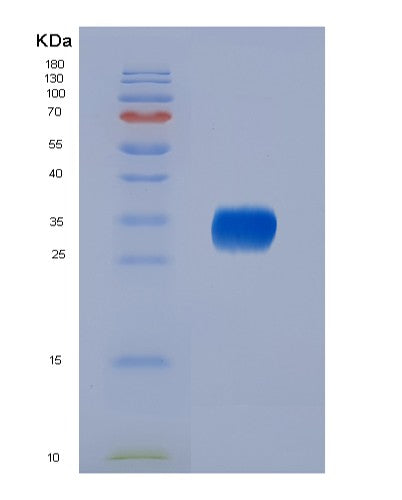 SDS-PAGE analysis of Mouse Il6 (Interleukin-6) - Recombinant Protein, showing >95% purity under 15% SDS-PAGE (Reduced)