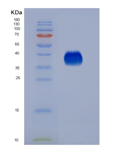 SDS-PAGE analysis of Mouse Il9 (Interleukin-9) - Recombinant Protein, showing >95% purity under 15% SDS-PAGE (Reduced)