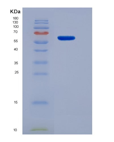 SDS-PAGE analysis of Mouse Lag3 (Lymphocyte Activation Gene 3 Protein) - Recombinant Protein, showing >95% purity under 15% SDS-PAGE (Reduced)