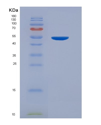 SDS-PAGE analysis of Mouse Tnfrsf11b (Tumor Necrosis Factor Receptor Superfamily Member 11B) - Recombinant Protein, showing >90% purity under 15% SDS-PAGE (Reduced)