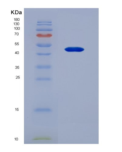 SDS-PAGE analysis of Human LBP (Lipopolysaccharide-Binding Protein) - Recombinant Protein, showing >95% purity under 15% SDS-PAGE (Reduced)