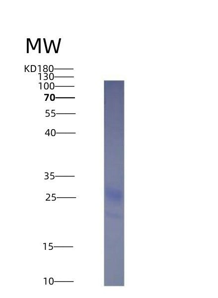 SDS-PAGE analysis of Mouse Tnfsf4 (Tumor Necrosis Factor Ligand Superfamily Member 4) - Recombinant Protein, showing >95% purity under 15% SDS-PAGE (Reduced)
