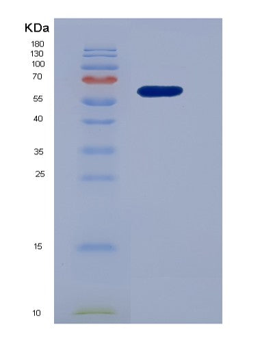 SDS-PAGE analysis of Human ACE (Angiotensin-Converting Enzyme) - Recombinant Protein, showing >95% purity under 15% SDS-PAGE (Reduced)