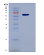 SDS-PAGE analysis of Human ACE (Angiotensin-Converting Enzyme) - Recombinant Protein, showing >95% purity under 15% SDS-PAGE (Reduced)