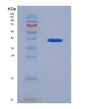 SDS-PAGE analysis of Human TREM1 (Triggering Receptor Expressed On Myeloid Cells 1) - Recombinant Protein, showing >95% purity under 15% SDS-PAGE (Reduced)