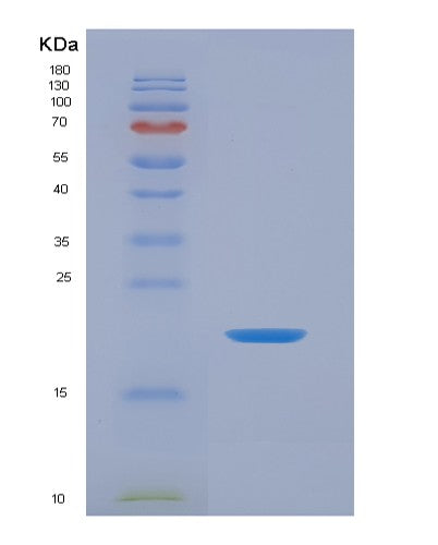 SDS-PAGE analysis of Human IL36G (Interleukin-36 Gamma) - Recombinant Protein, showing >90% purity under 15% SDS-PAGE (Reduced)