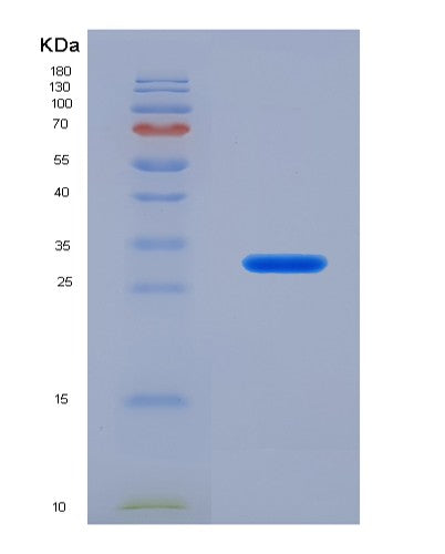 SDS-PAGE analysis of Human ADCY5 (Adenylate Cyclase Type 5) - Recombinant Protein, showing >90% purity under 15% SDS-PAGE (Reduced)