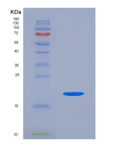 SDS-PAGE analysis of Human CALCA (Calcitonin) - Recombinant Protein, showing >90% purity under 15% SDS-PAGE (Reduced)