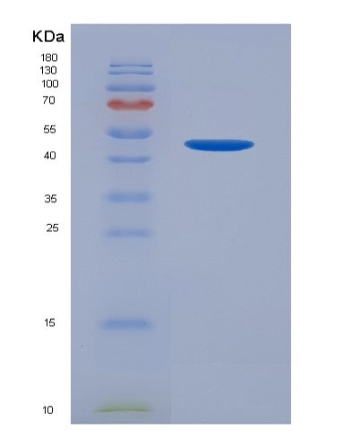 SDS-PAGE analysis of Human MUC1 (Mucin-1) - Recombinant Protein, showing >90% purity under 15% SDS-PAGE (Reduced)