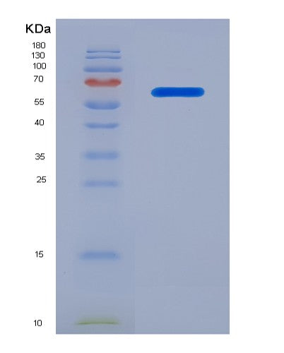 SDS-PAGE analysis of Human PRKCQ (Protein Kinase C Theta Type) - Recombinant Protein, showing >90% purity under 15% SDS-PAGE (Reduced)
