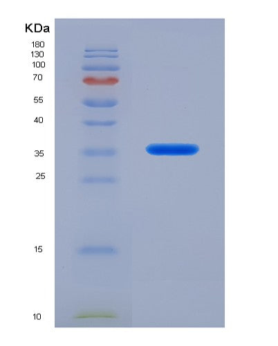 SDS-PAGE analysis of Human IL21 (Interleukin-21) - Recombinant Protein, showing >90% purity under 15% SDS-PAGE (Reduced)
