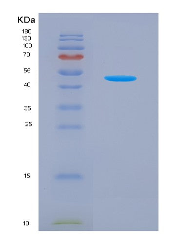 SDS-PAGE analysis of Mouse Il21 (Interleukin-21) - Recombinant Protein, showing >85% purity under 15% SDS-PAGE (Reduced)