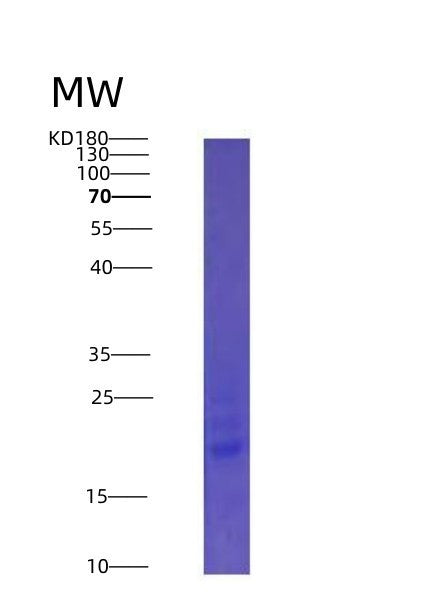 SDS-PAGE analysis of Human IL25 (Interleukin-25) - Recombinant Protein, showing >90% purity under 15% SDS-PAGE (Reduced)
