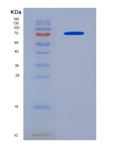 SDS-PAGE analysis of Human SERPINE1 (Plasminogen Activator Inhibitor 1) - Recombinant Protein, CAT# BLT-08447P showing >90% purity under 15% SDS-PAGE (Reduced)