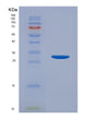 SDS-PAGE analysis of Human DNMT1 (Dna (Cytosine-5)-Methyltransferase 1) - Recombinant Protein, showing >90% purity under 15% SDS-PAGE (Reduced)
